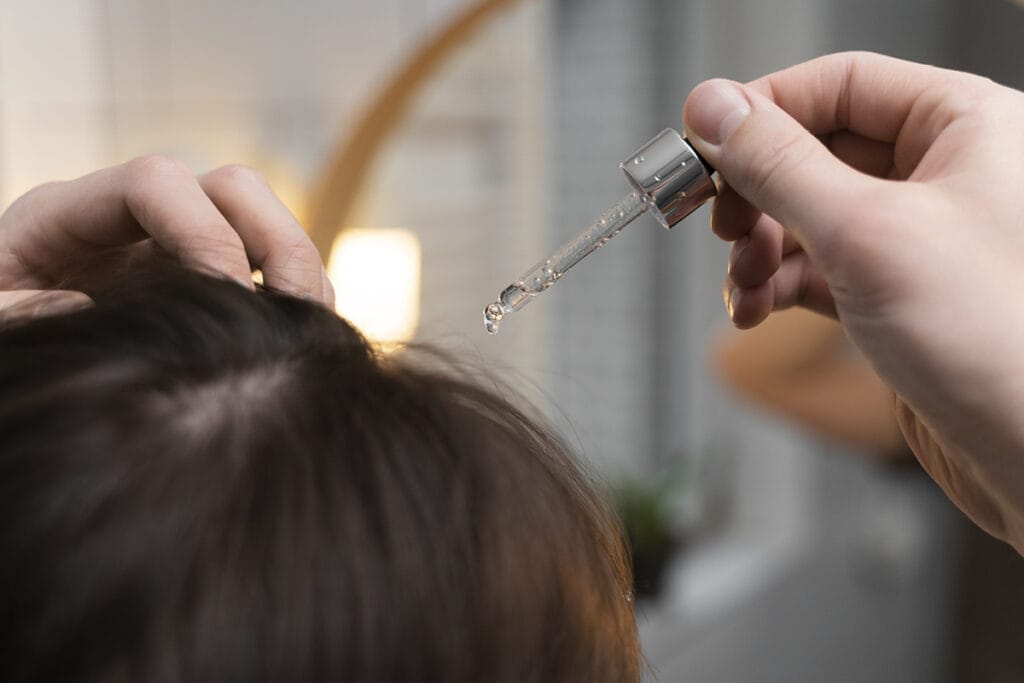 Rešitev za izpadanje las in alopecijo